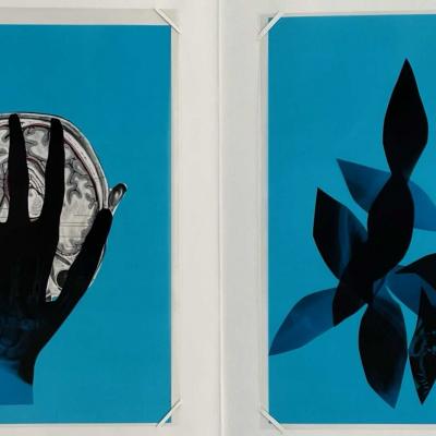 Collage Radiographie 02